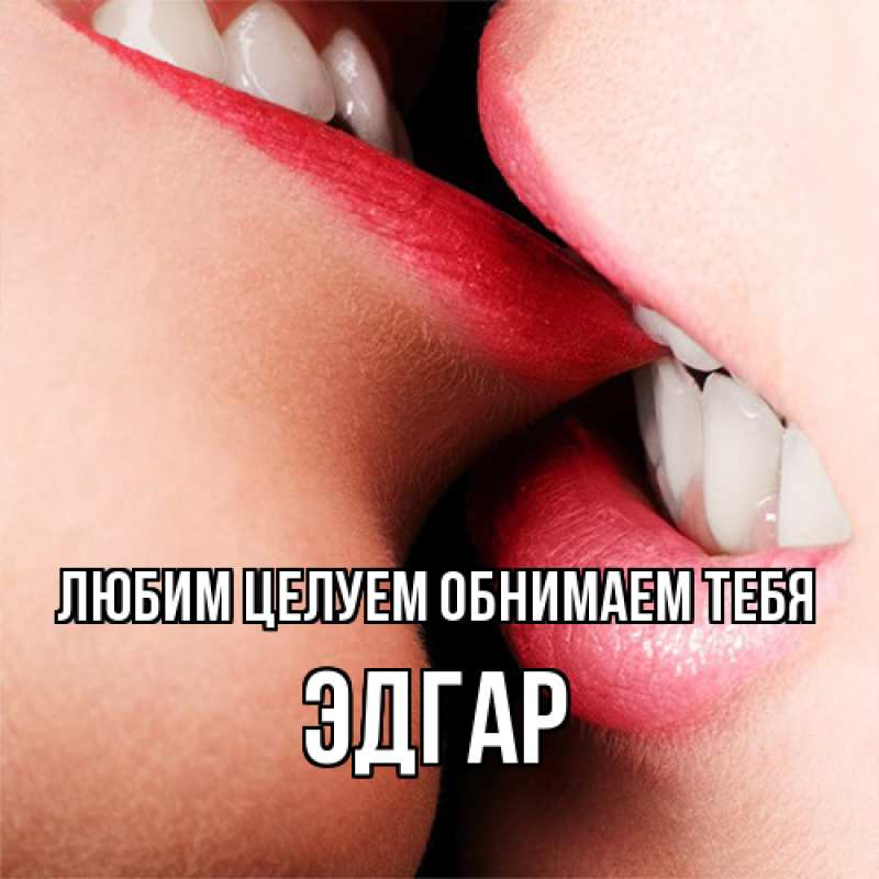 Открытка с именем, Эдгар, Любим целуем обнимаем тебя